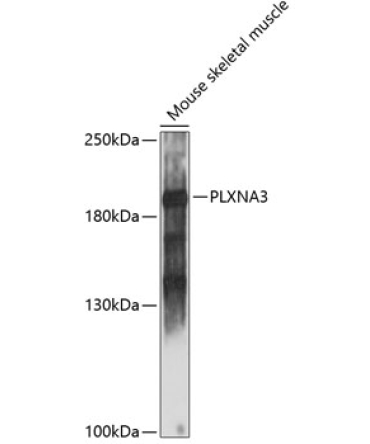 PLXNA3 Rabbit Polyclonal Antibody