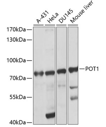 POT1 Rabbit Polyclonal Antibody