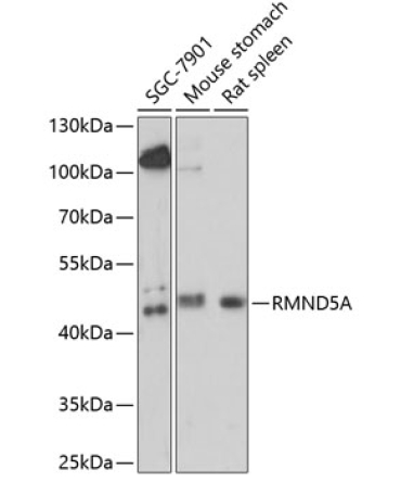 RMND5A Rabbit Polyclonal Antibody