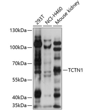 TCTN1 Rabbit Polyclonal Antibody