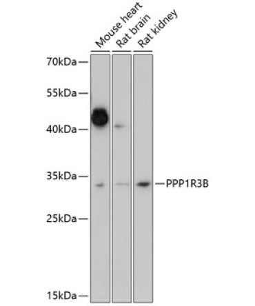 PPP1R3B Rabbit Polyclonal Antibody