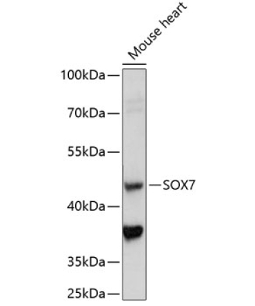 SOX7 Rabbit Polyclonal Antibody