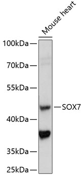SOX7 Rabbit Polyclonal Antibody