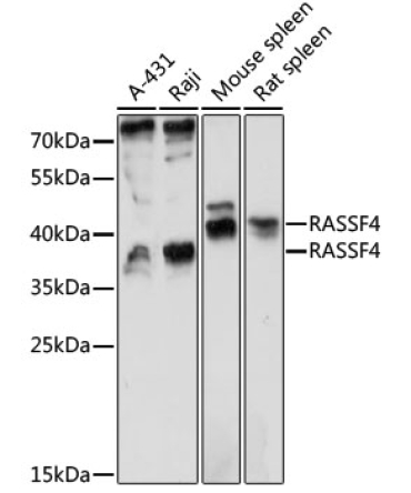 RASSF4 Rabbit Polyclonal Antibody