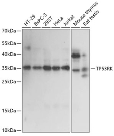 TP53RK Rabbit Polyclonal Antibody