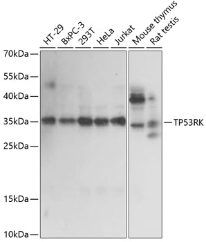 TP53RK Rabbit Polyclonal Antibody
