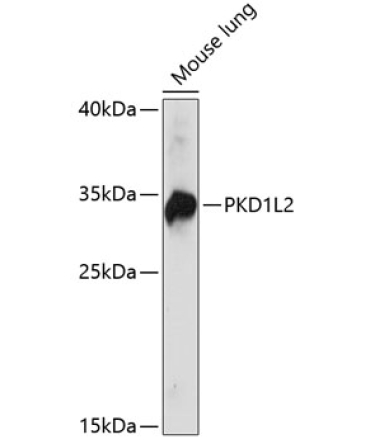 PKD1L2 Rabbit Polyclonal Antibody