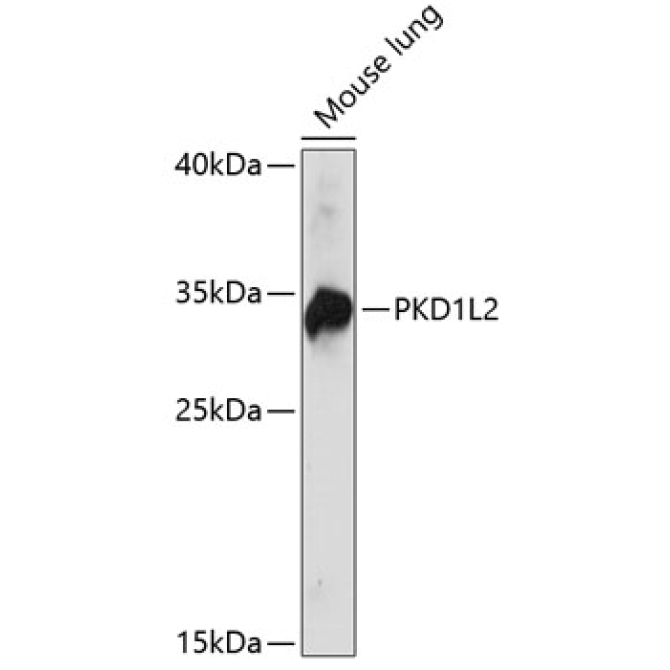 PKD1L2 Rabbit Polyclonal Antibody