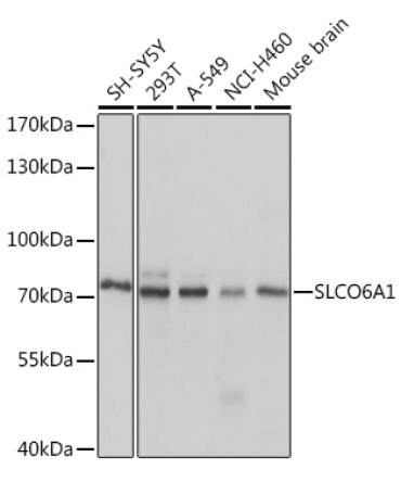 SLCO6A1 Rabbit Polyclonal Antibody