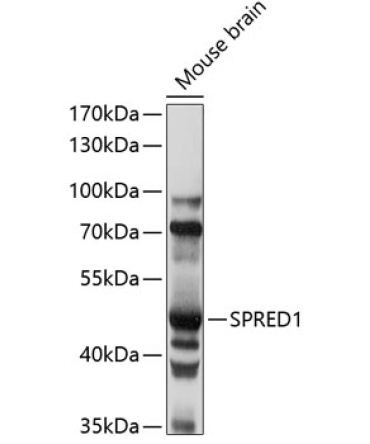 SPRED1 Rabbit Polyclonal Antibody