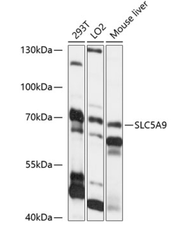 SLC5A9 Rabbit Polyclonal Antibody