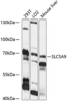 SLC5A9 Rabbit Polyclonal Antibody