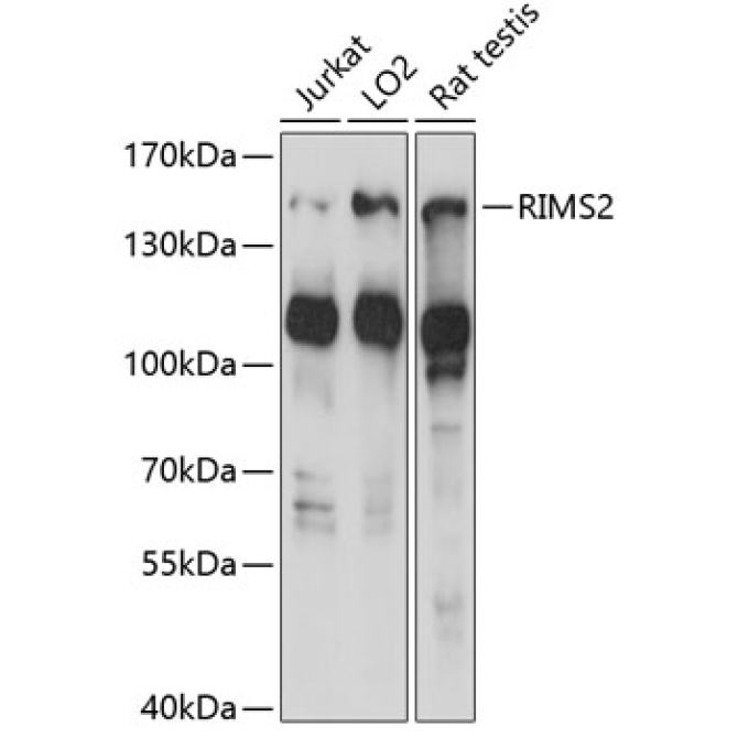 RIMS2 Rabbit Polyclonal Antibody