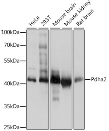 PDHA2 Rabbit Polyclonal Antibody