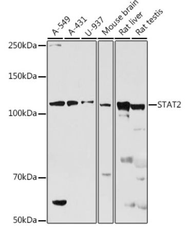 STAT2 Rabbit Polyclonal Antibody