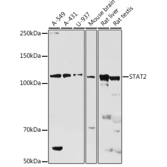 STAT2 Rabbit Polyclonal Antibody