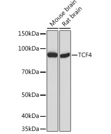 TCF4 Rabbit Polyclonal Antibody