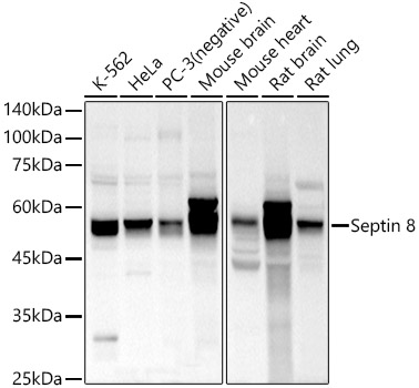 Septin 8 Rabbit Polyclonal Antibody