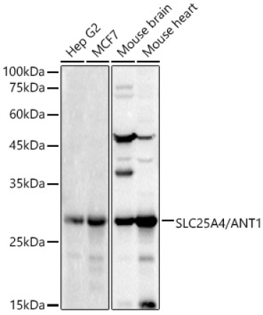 SLC25A4/ANT1 Rabbit Polyclonal Antibody