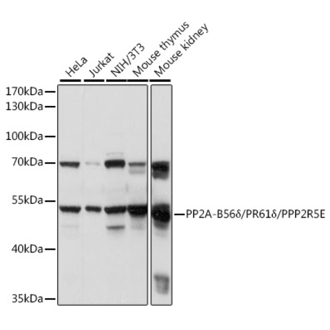 PP2A-B56Delta/PR61Delta/PPP2R5E Rabbit Polyclonal Antibody