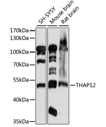 THAP12 Rabbit Polyclonal Antibody