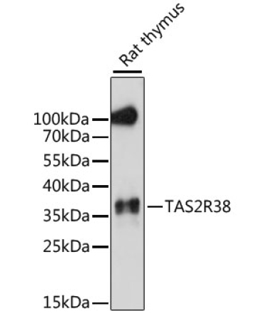 TAS2R38 Rabbit Polyclonal Antibody