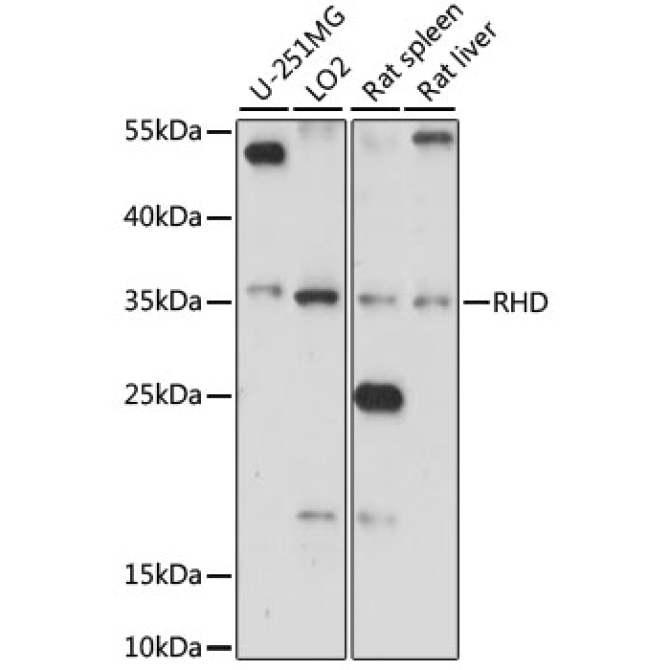 RHD Rabbit Polyclonal Antibody