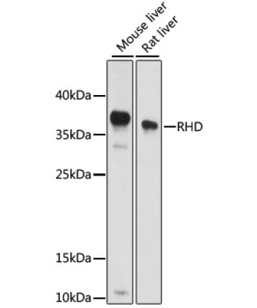 RHD Rabbit Polyclonal Antibody