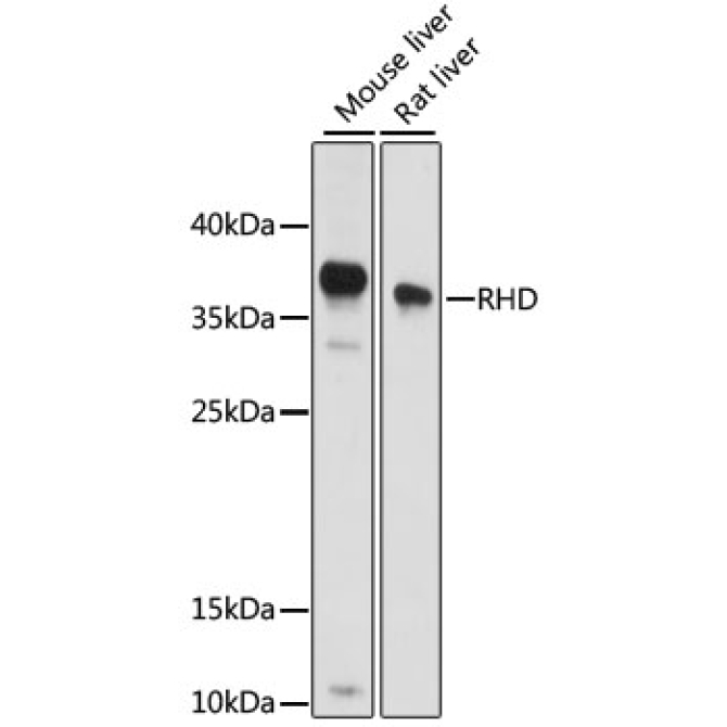 RHD Rabbit Polyclonal Antibody