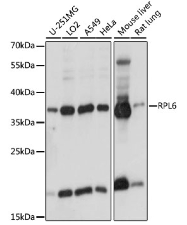 RPL6 Rabbit Polyclonal Antibody