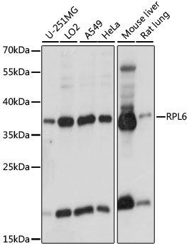 RPL6 Rabbit Polyclonal Antibody
