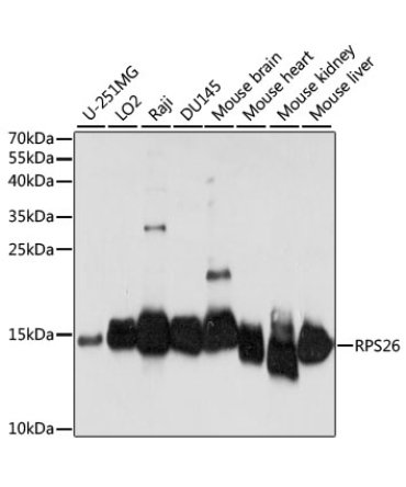 RPS26 Rabbit Polyclonal Antibody