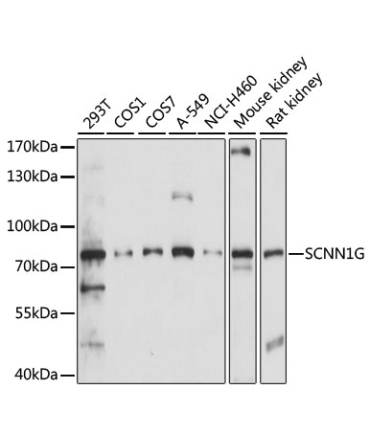 SCNN1G Rabbit Polyclonal Antibody