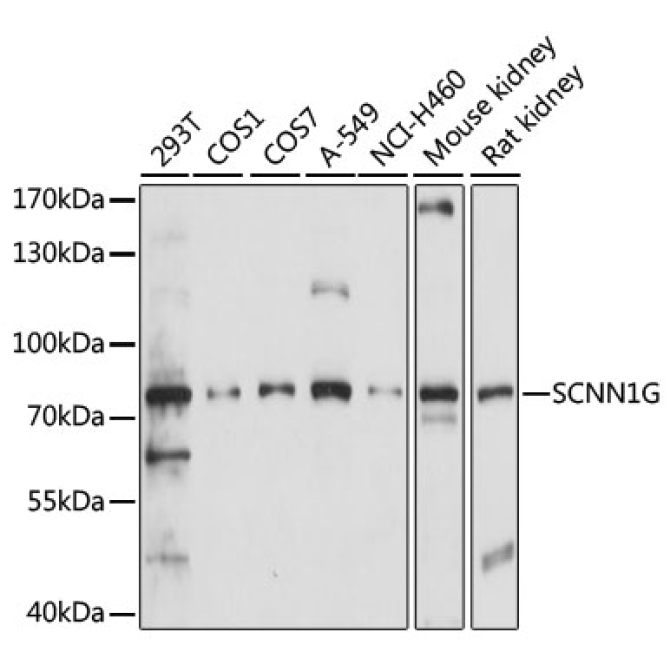 SCNN1G Rabbit Polyclonal Antibody