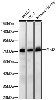 SIM2 Rabbit Polyclonal Antibody