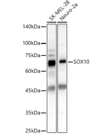 SOX10 Rabbit Polyclonal Antibody