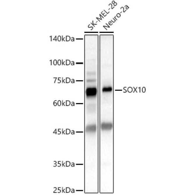 SOX10 Rabbit Polyclonal Antibody