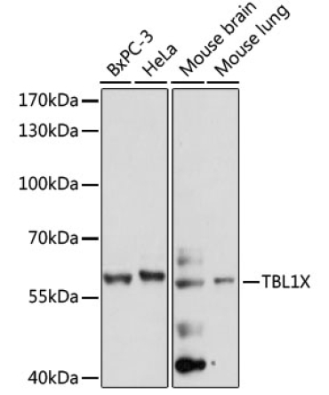TBL1X Rabbit Polyclonal Antibody