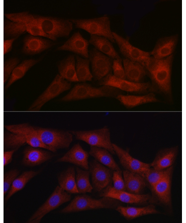 TGF beta 1 Rabbit Polyclonal Antibody