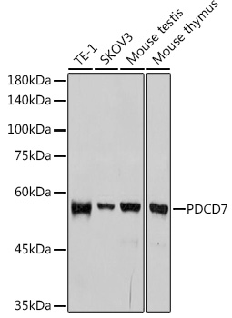 PDCD7 Rabbit Monoclonal Antibody