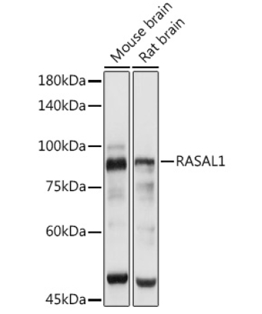 RASAL1 Rabbit Polyclonal Antibody