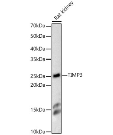 TIMP3 Rabbit Polyclonal Antibody