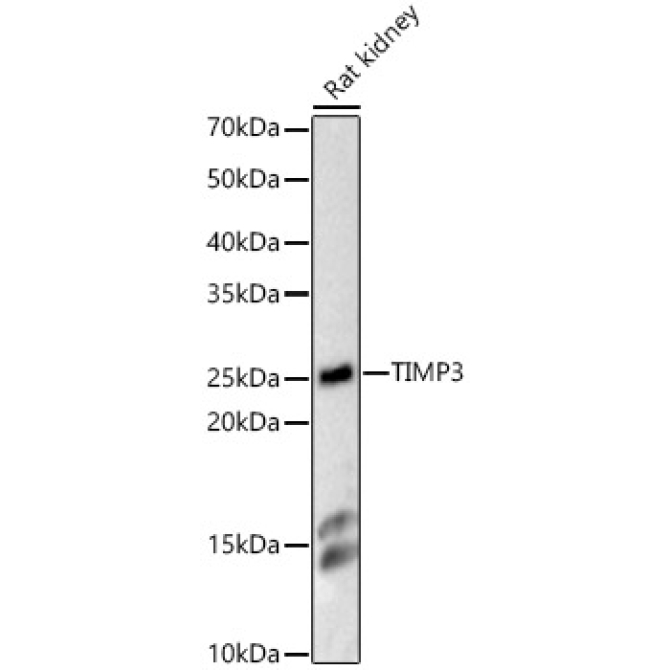 TIMP3 Rabbit Polyclonal Antibody