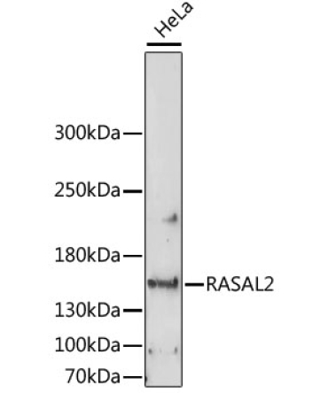 RASAL2 Rabbit Polyclonal Antibody