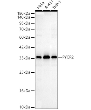 PYCR2 Rabbit Polyclonal Antibody
