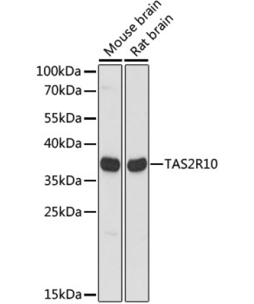 TAS2R10 Rabbit Polyclonal Antibody