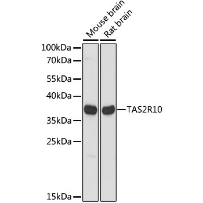 TAS2R10 Rabbit Polyclonal Antibody