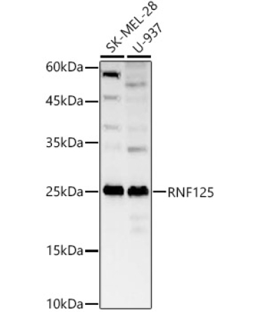 RNF125 Rabbit Polyclonal Antibody