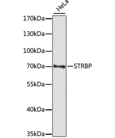 STRBP Rabbit Polyclonal Antibody