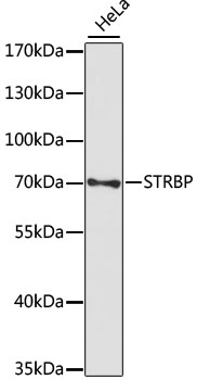 STRBP Rabbit Polyclonal Antibody